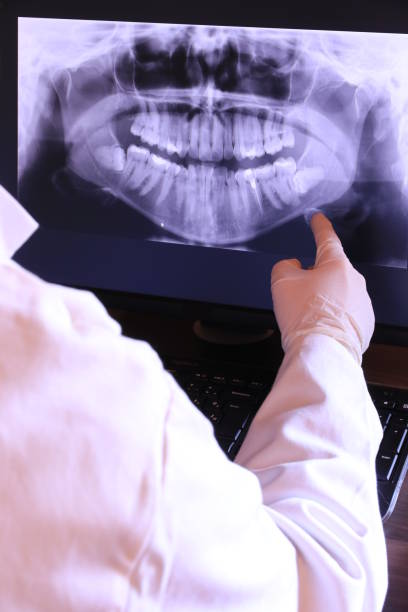 Best Emergency Dental Care for Broken or Chipped Teeth in North Redington Beach, FL